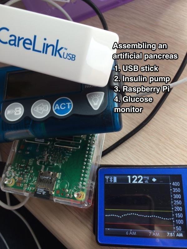 Pancréas artificiel pour diabétiques géré par un Raspberry Pi