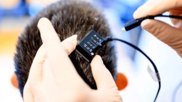 AI Restores Speech for People with Paralysis